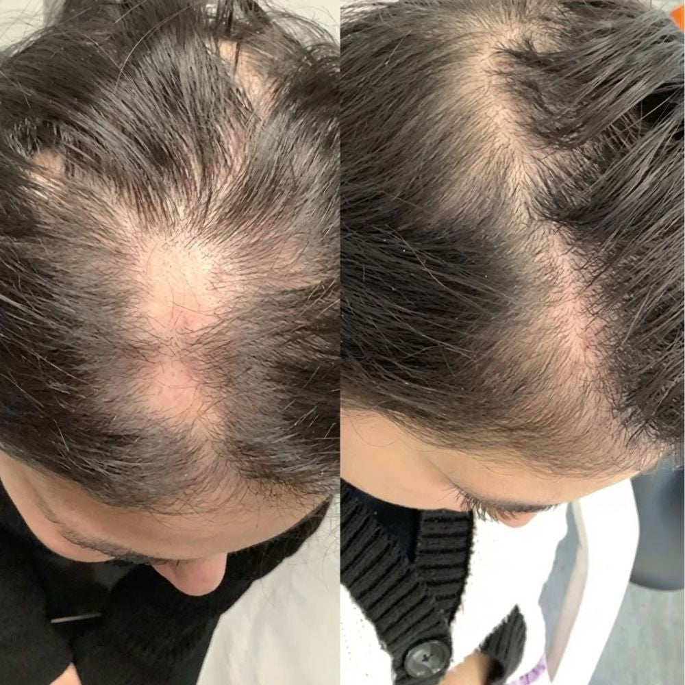 Veluria Halo Essential