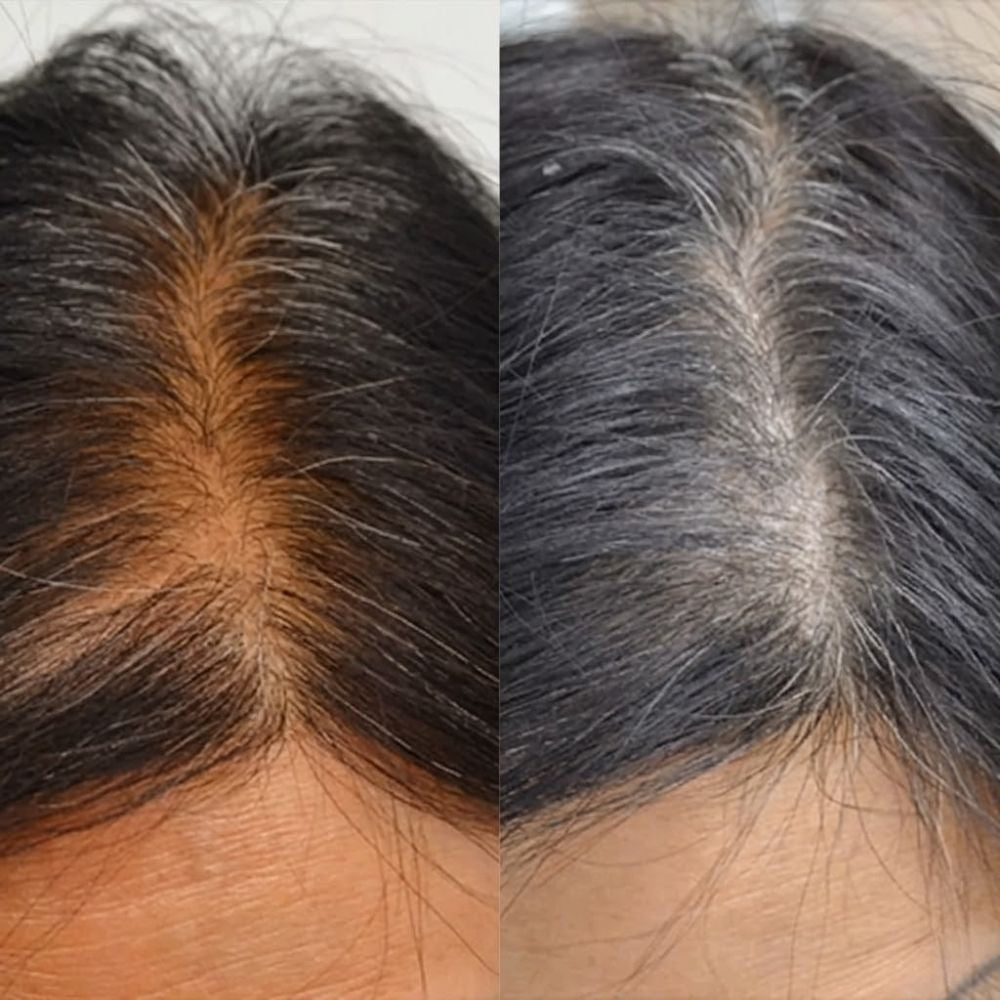 Veluria Halo Essential