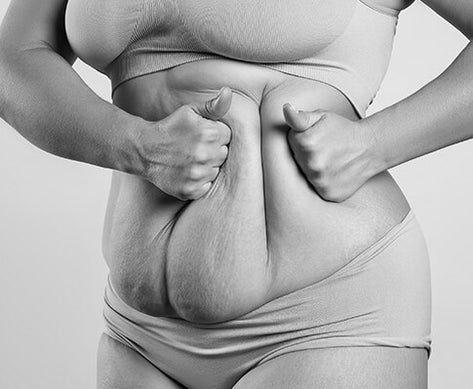 Kroppsförändringar efter graviditet och förändrad form.